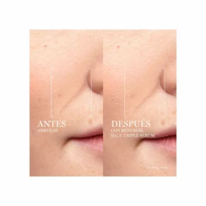 Lancôme Rénergie HCF Triple Serum - Image 3