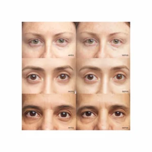 Clinique All About Eyes Brightening Serum Concentrate Retinoid + Vit C + HA - Image 6